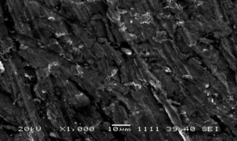 Figure 4 SEM of Pt/polypyrrole-ferrocenium-uricase-gelatine-glutaraldehyde.