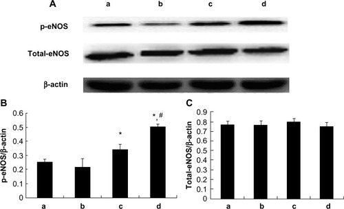 Figure 8 Myocardial total-eNOS and p-eNOS expression. (A) p-eNOS and total-eNOS protein expressions detected by Western blotting; (B) Relative protein expression level of p-eNOS; (C) Relative protein expression level of total-eNOS; (a) control group; (b) 1 μM picroside II pretreatment group; (c) 10 μM picroside II pretreatment group; and (d) 100 μM picroside II pretreatment group.