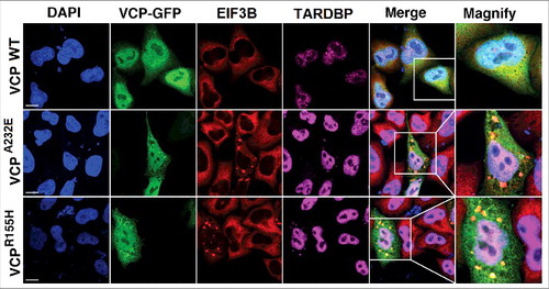 Figure 8. Effect of mutated forms of VCP (A232E and R155H) on the formation of constitutive SGs and the recruitment of TARDBP to those SGs. HeLa cells were transfected with plasmid expressing wild-type or mutant VCP-GFP forms and stained for the SG marker EIF3B and TARDBP. Overexpression of mutant but not wild-type VCP resulted in the formation of TARDBP-containing SGs. Scale bar: 10 µm. Reproduced with permission from ref. Citation655.