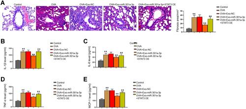 Figure 7 Exosomal miR-301a-3p inhibits OVA-induced lung injury by targeting STAT3 in mice. (A) Fibrosis in mouse lung tissues was measured by Masson’s trichrome staining. (B–E) Secretion of IL-1β, IL-6, TNF-α, and MCP-1 was measured by ELISA kits. n = 5. **p < 0.01.