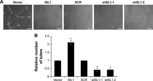 Figure 4 Downregulation of ISL1 suppresses angiogenesis in breast cancer.