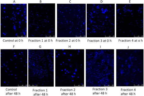 Figure 4. Morphological features of nuclei of H1299 cells treated with four fractions of Syzygium aromaticum for 8 h.