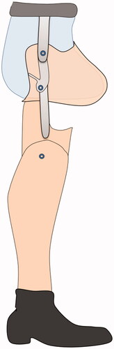 Figure 4. A bent transfemoral socket attached to the wooden shank via the sidebars with an extra joint allowing more flexion when seated.