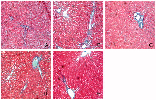 Figure 5. Histological examination of liver in Masson’s trichrome staining. (A) Normal; (B) control diabetic; (C) diabetic + TGP 50 mg/kg; (D) diabetic + TGP 100 mg/kg; (E) diabetic + TGP 200 mg/kg. Original magnification 100×.