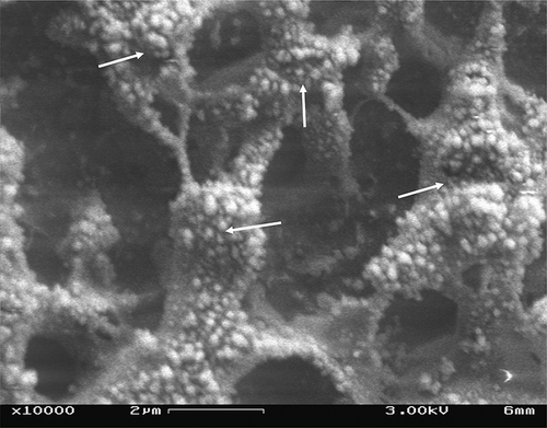 Figure 5 Cryogenic scanning electron microscope image of Process A (one-pass homogenization at 96.53 MPa with no preheating) soymilk, the arrows show that the particles are still coalescing, unhydrated without any pattern of distribution, and large in size.