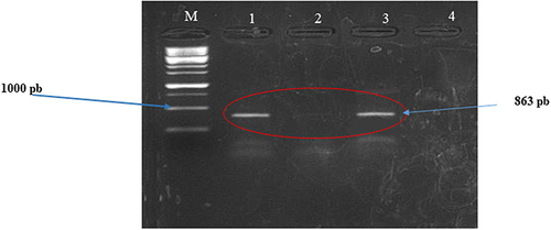 Figure 2 Agarose gel with the GES gene. M = Molecular weight marker, numbers 1: 1 = Positive control; 2 = Negative control; 3 = GES gene; 4 = Vaginal swab, the red circle indicates the position of the GES gene bands. The meaning of Electrophoresis migration is from top to bottom.