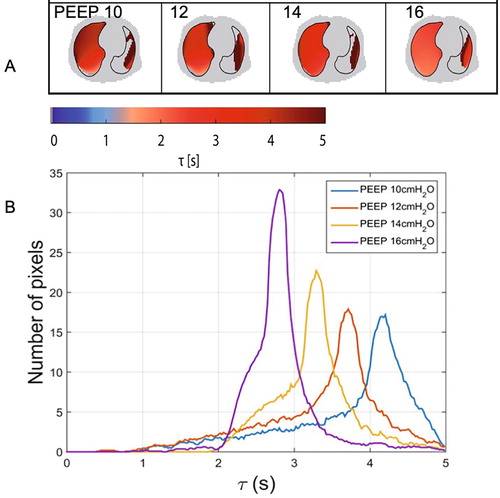 Figure 3. Analysis of distribution of time constants in patient with severe COPD. Distribution of time constants is seen in a 2-D image (A) and distribution of pixels with different time constants at different PEEP levels (B). Adapted from [Citation158]. Reproduced with permission under the Creative Commons license (http://creativecommons.org/publicdomain/zero/1.0/).