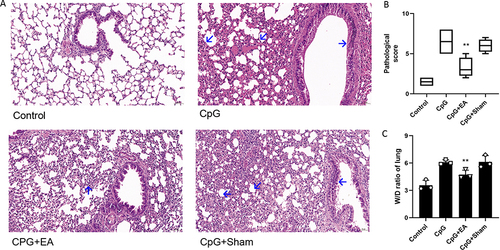 Figure 3 EA pretreatment reversed CpG-induced lung edema and alleviated lung injury. (A) H+E staining assessing lung injury induced by CpG. (B) Pathological score of lung injury. (C) The W/D ratio of the lung. **P < 0.01 compared to the CpG group (n=6). Data are analyzed by using one-way analysis of variance followed by Tukey’s multiple comparison test and are representative of three independent experiments.