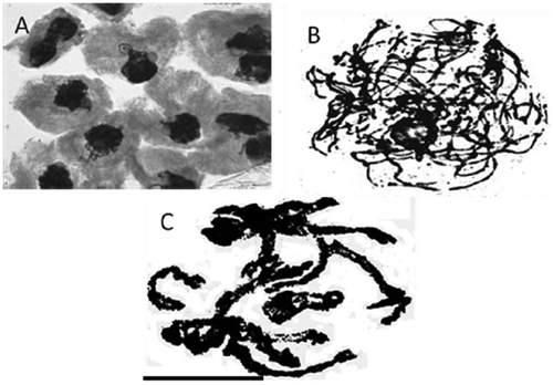 Figure 2. Representative pollen mother cells of Anchusa species showing prophase-I sub-stages of meiosis. (A) synezetic knot in Kilak population of A. italica var. kurdica; (B) pachytene stage in Evin population of A. italica var. italica; (C) diplotene stage in Evin population of A. italica var. italica (scale bar = 20 μm).