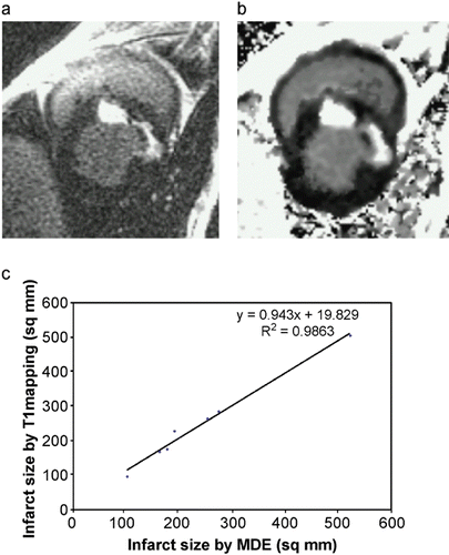 Figure 1. (a) MDE image from a dog (b) Corresponding R1 map (c) Correlation of infarct size between MDE and T1 mapping. (View this art in color at www.dekker.com.)