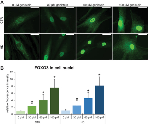 Figure 14. Translocation of FOXO3 from the cytoplasm to the nucleus in HD and control cells treated with genistein. Fibroblasts derived from HD patients (HD) or control, healthy persons (CTR) were cultured and treated with either 0.1% DMSO or genistein (at the final concentration of 30, 60 or 100 µM) for 24 h. Translocation of FOXO3 from the cytoplasm to the nucleus in cell culture experiments was observed by fluorescence microscopy (A), and quantification of the signals was conducted by measurement of fluorescence intensity in 100 randomly chosen cells from each sample (B). Bars in panel A: 25 µm. Statistically significant differences (at p < 0.05) relative to untreated control (CTR) cells or HD cells are indicated in panel B by asterisks or hashtags, respectively.