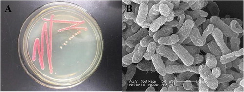 Figure 1. Morphological observation of the steroid estrogen-degrading strain DH-S01. Colony morphology (A) and scanning electron micrographs (B).