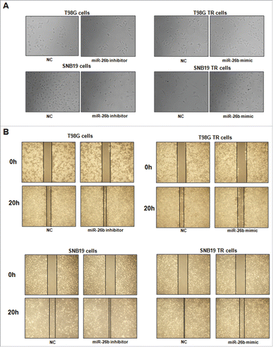 Figure 5. miR-26b inhibitor enhanced motility and invasion in glioma cells.(A) Cell morphology was taken by microscopy in parental cells treated with miR-26b inhibitor or miR-26b mimics. (B) Wound healing assays were used to detect the motility in SNB19 and T98G cells transfected with miR-26b inhibitor or miR-26b mimics.
