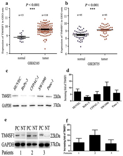 Figure 1. Upregulation of TM4SF1 expression in pancreatic cancer tissues and cell lines. (a) and (b). The GEO profile datasets. TM4SF1 expression was upregulated in 118 and 45 pancreatic cancer samples (Tumor) compared with that of 13 and 45 normal tissue samples (Normal). (c) and (d). Western blot and qRT-PCR. The level of TM4SF1 mRNA and protein was assessed using qRT-PCR and Western blot, respectively, in pancreatic cancer cell lines (SW1990, PANC-1, BxPC-3 and CFPAC-1) and HUVECs. E and F. Western blot and qRT-PCR. Level of TM4SF1 mRNA and protein was determined in the three pairs of pancreatic cancer and normal tissue samples using qRT-PCR and Western blot, respectively.