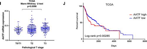 Figure 2 AATF expression in HNSCC tissues using ONCOMINE microarray and TCGA databases. (A–C) Analysis of Estilo Head-Neck, Talbot, and Ye Head-Neck of Oncomine datasets. AATF mRNA expression was higher in tongue squamous cell carcinoma compared with normal tongue tissues. (D) Sengupta Head-Neck of Oncomine showed that AATF mRNA was higher in nasopharyngeal carcinoma compared with normal nasopharynx. (E) Ginos Head-Neck dataset demonstrated that AATF mRNA was elevated in HNSCC compared with buccal mucosa. (F) Peng Head-Neck dataset indicated that AATF was elevated in oral cavity squamous cell carcinoma compared with normal oral cavity. (G) Analysis of TCGA dataset showed that AATF mRNA in 502 cases of HNSCC was higher than that in 44 cases of normal tissues. (H) Analysis of 43 cases of paired of HNSCC with corresponding normal tissues from TCGA showed that AATF showed significant higher levels in HNSCC compared with corresponding normal tissue. (I) TCGA data showed that AATF mRNA was higher in HNSCC with higher pathological T stage. (J) Kaplan–Meier curves using TCGA survival data showed that high AATF levels was associated with poor survival in HNSCC patients.