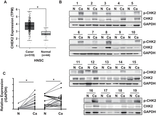 Figure 1 CHK2 is overexpressed in LSCC. (A) The mRNA expression of CHEK2 in HNSC tissues and control normal tissues in TCGA database. *P<0.05. (B) Western blot analysis for CHK2 expression in 19 paired LSCC tissues and matched adjacent nontumor tissues. N, adjacent nontumor tissues; Ca, LSCC tissues. GAPDH was used as the loading control. (C) Data from (B) were quantified by densitometry, with GAPDH as the reference. Student’s t-test was used for statistical significance. Gray lines indicate the samples with higher expression of p-CHK2 or CHK2 in cancer tissues, and black lines indicate the samples with lower expression of CHK2 in cancer tissues. *P<0.05.