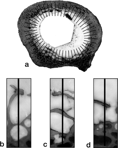 Figure 3. Illustration of the scheme devised to estimate the fraction of non-apposed cement-bone interface:(a) Transverse section of a stem-cement-femur construct overlaid with a set of 50 lines normal to an ellipse fitted to the cement-bone interface.Examples are shown of:(b) full apposition, count + 0;(c) mixed apposition, count + 1/2; (d) non-apposition, count + 1.The non-apposed interface for each section was estimated from count divided by 50.The fraction of non-apposed cement-bone interface for each stem-cement-femur construct was estimated from the mean of its sections.