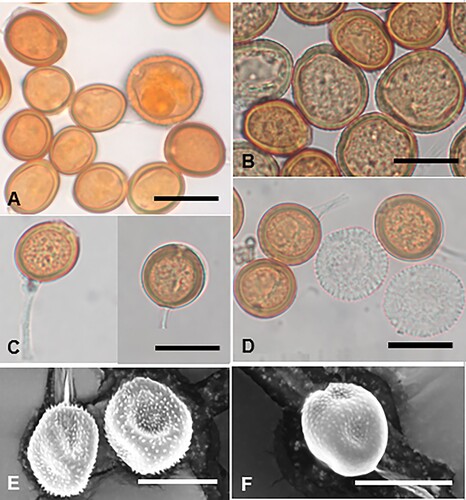 Figure 31. Uromyces rytidospermatis on Rytidosperma spp.: A, Urediniospore and teliospores (PDD 105364, holotype). B, urediniospores and teliospores (PDD 19849). C, D, teliospores (PDD 19849). E, SEM image of urediniospore. F, SEM image of teliospore. Scale bars = 20 μm.