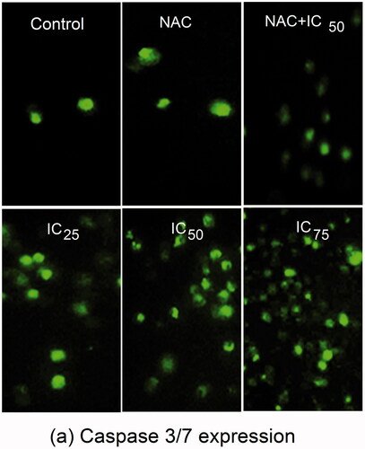 Figure 8. Fluorescence images showing an increase in expression of caspase 3/7 in SKOV3 cells treated with NAC, IC25, IC50, IC75 and NAC + IC50 concentrations of RS-AgNPs at 24 h, which showed a concentration dependent increase an expression of caspase 3/7.