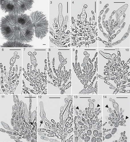 Figs 2–14. Batrachospermum gelatinosum. Fig. 2. Whorls with carposporophytes. Figs 3–5. Lanceolate, sessile trichogynes with more or less elongated end and more or less swollen central part (marked Ge.(sk) in the text) from specimens collected at springs Pellegrina (Fig. 3), Isso Piccolo (Fig. 4), and Crocetta (sequenced specimen, Fig. 5). Figs 6, 7. Deformed trichogynes with long basal stalk or just a hinted knob (marked Ges(k) in the text) from a specimen collected at Cna Volpe, the spring with the best environmental conditions among the 23 investigated. Figs 8–10. Deformed trichogynes with more or less long stalk and knobs (marked Ge.sk in the text) from specimens collected in three springs with the poorest environmental conditions [Pratizagni (Fig. 8), Saragozza (Fig. 9), Fascina (Fig. 10)]. Fig. 11. Three carpogonia on the same fascicle branch from the sequenced specimen collected at the spring Averolda. Note the basal knob (arrow) on trichogyne of the central carpogonium (arrow). Fig. 12. Two carpogonia on the same fascicle branch from the sequenced specimen collected at the spring Est Pompiano, the one on the left with stalk and knob (arrow). Figs 13, 14. B. gelatinosum f. spermatoinvolucrum. Specimen sequenced with spermatangia on the top of involucral filaments (arrowheads). Fig. 2, scale bar = 50 µm; Figs 3–14, scale bar = 20 µm.