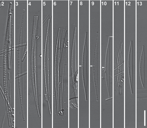 Figs 2–13. Nitzschia varelae, sp. nov. from Valdoviño Lagoon (Figs 2–7, 10 and 11) and Clot Lagoon (clone NIT952cat: Figs 8, 9, 12 and 13), LM, differential interference contrast optics. Figs 2, 4, 6 & 11. Frustules in valve view: note that the raphe systems of the two valves lie on the same side (left). Figs 2–13. Valves at different stages of size reduction, with the raphe always on the more convex side. Note the tendency of the valves to become more strongly differentiated into a linear central section and narrowly rostrate ends during size reduction, the wider separation of the central fibulae in all specimens, and the central nodule (e.g. arrowheads), which marks the position of the central raphe endings. Scale bar = 10 µm.