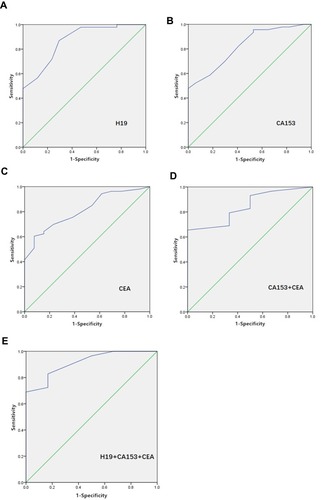 Figure 3 The ROC curves of biomarkers. (A) The ROC curve of exosomal H19. The area under the curve was 0.870. (B) The ROC curve of CA153. The area under the curve was 0.822. (C) The ROC curve of CEA. The area under the curve was 0.811. (D) The ROC curve of combined CA153 and CEA. The area under the curve was 0.845. (E) The ROC curve of combined CA153, CEA, and exosomal H19. The area under the curve was 0.914.