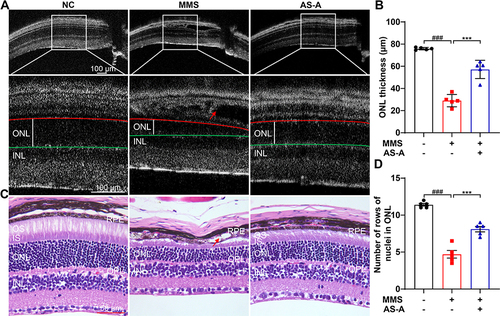 Figure 12 AS-A protects against MMS-induced retina degeneration. C57/BL6J mice were challenged by MMS at 55 mg/kg bw, followed by the treatment 0.9% saline solution (MMS) or AS-A at 100 mg/kg bw (AS-A) twice a day for 7 days. C57/BL6 mice without MMS challenge received vehicle treatment in the same manner (NC). (A) Seven days after MMS challenge, OCT imaging was performed to visualize the retinal microstructure. (B) The thickness of ONL was measured at 500 μm off the ONH. (C) Histological examination was performed by HE staining of the paraffin sections. Representative micrographs were presented showing the morphological features of the central retina. (D) The number of rows of nuclei in ONL was measured. Red arrows point to subretinal edema and damaged RPE. White asterisk points to diminished IS/OS. Data were expressed as mean±S.E.M (n=5 per group). ### Compared to that from NC, P<0.001; *** compared to that from MMS, P<0.001.