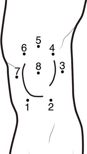 Figure 7 Points of assessment for topographical pressure pain sensitivity maps of the knee.