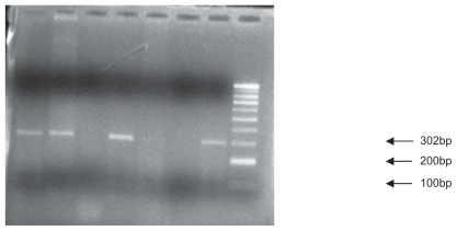 Figure 1 Polymerase chain reaction product: The primers produce polymerase chain reaction products of either 302 base pairs.