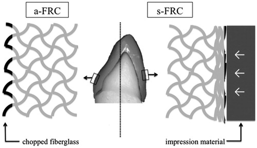 Figure 6. A schematic drawing of the distinct distributions of fiberglass (black lines) on the prosthetic surfaces of single-structure FRC restorations. The fiberglass in a-FRC was chopped during the milling of CAD/CAM (left), while the fiberglass in s-FRC was crushed by the impression material during the preparation (right). Abbreviations: CAD/CAM: computer-aided design and manufacturing; FRC: fiber-reinforced composite.