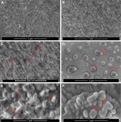 Figure 3 SEM micrographs of oligoDapT (A–C), oligoDapT/DNA complex (D and E), and oligoDapT/RNA complex (F).Notes: (A, B, D, E, and F) 100,000×, 1 μm; (C) 200,000×, 500 nm.Abbreviation: SEM, scanning electron microscopy.