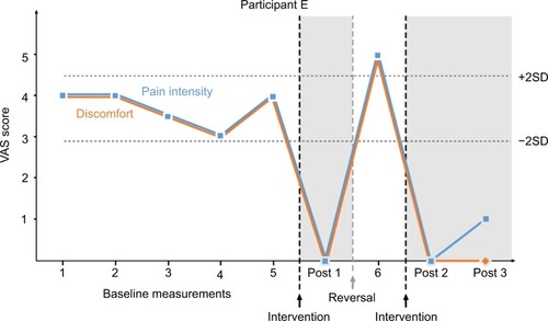 Figure 5 Participant E’s ratings of pain intensity and level of discomfort. Baseline measurements were taken at 5 hours 10 minutes, 2 hours 20 minutes, 1 hour 20 minutes, 5 minutes and 0 minutes prior to intervention. Post 3 was taken 5 minutes after Post 2.