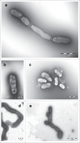 Figure 3. Transmission electron micrographs (JEM-1011; JEOL, Freising, Germany) of cells of a: Streptobacillus moniliformis DSM 12112T, b: Streptobacillus felis 131000547T, c: Streptobacillus ratti OGS16T, d: Streptobacillus notomytis AHL 370–1T and e: Streptobacillus hongkongensis DSM 26322T. All strains were grown on sheep blood agar at 37°C for 7 d. Images were taken with negative contrast (PTA method) at ×3000 to ×10,000 magnifications. Bars, 500 nm, 1000 and 2000 nm, respectively.