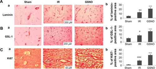 Figure 2 Photomicrographs of immunohistochemistry of blood vessel markers and cell proliferation marker at 14 days after IR.