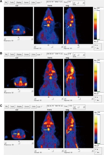 Figure 3 PET images with 18F-fallypride of control and tumor group rats.