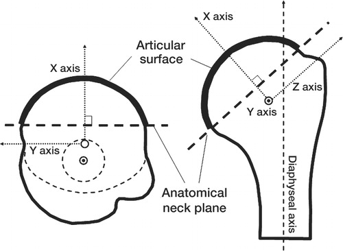 Figure 2. (A) Definition of three-dimensional coordinate system of the humeral head (diagram shows a right-side specimen). The data points of the articular surface were extracted by the anatomical neck plane. The origin is defined as a center point of the whole articular surface. The x-axis is defined as a line passing through the origin and perpendicular to the anatomical neck plane. The y-axis is defined as a line passing through the origin which was perpendicular to the x-axis and the diaphyseal axis. The z-axis is perpendicular to x- and y-xes.
