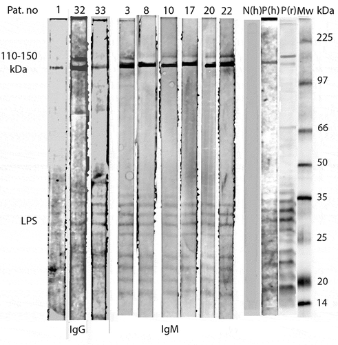 Figure 1. Western Blot analysis of IgG and IgM antibodies against R. helvetica whole cell antigen demonstrates the lipopolysaccaride (LPS) ladders and specific reactions against R. helvetica proteins in the 110–150-kDa region in serum for IgG for patients 1, 32 and 33 and for IgM for patients 3, 8, 10, 17, 20 and 22 in dilution 1:200. Lane P(h) demonstrates specific proteins and the LPS ladders reacting with a positive human serum and P(r) with a polyclonal rabbit antiserum. N(h) represent a negative human serum control