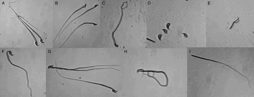 Figure 1.  Photomicrographs of the commonly observed abnormal sperms from the 100 mg/L molybdenum dose group. A) normal morphology; B) big head (arrow heading); C) pin head; D) no tail attached; E) without the main section; F) without characteristic curvature; G) two main sections; H) rolled into a spiral; and I) no head attached.