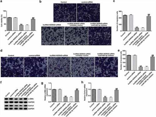 Figure 4. Knockdown of lncRNA NORAD inhibited cell viability, migration, and invasion in activated HSCs by targeting miR-495-3p. PDGF-BB-treated LX-2 cells were transfected with control siRNA, lncRNA NORAD siRNA, lncRNA NORAD siRNA + inhibitor control, or lncRNA NORAD siRNA + miR-495-3p inhibitor for 24 h. (a) MTT assay was conducted to measure cell viability. (b, c) Transwell assay was performed to evaluate cell migration (magnification: 200×). (d, e) Transwell assay was performed to evaluate cell invasion (magnification: 200×). (f) Markers of activated HSCs (α-SMA and Col1α1) were detected by Western blot assay. (g) mRNA level of α-SMA was verified by qRT-PCR analysis. (h) mRNA level of Col1α1 was verified by qRT-PCR analysis. Data were expressed as means ± SD, and experiments were repeated for at least for 3 times. **p < 0.01 vs. control-siRNA; ##p < 0.01 vs. lncRNA NORAD-siRNA+inhibitor control.