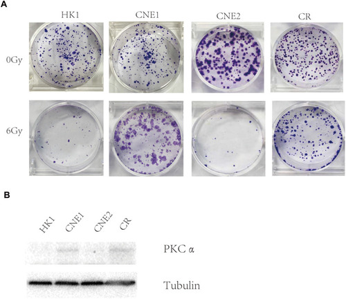 Figure 3 PKCα expression in NPC cell lines. (A) Clonogenic assay of HK1, CNE2, CNE1 and CR cells after exposure to 0 and 6 Gy radiation (n=3; P<0.05). (B) Western blotting analysis of PKCα expression in HK1, CNE1, CNE2 and CR cells, Tubulin was used as a loading control.