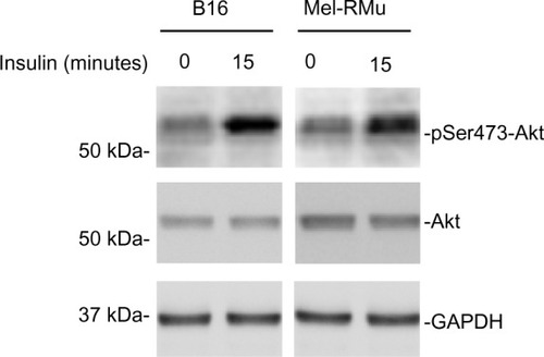 Figure 4 Insulin activates the PI3K/Akt in melanoma cells.
