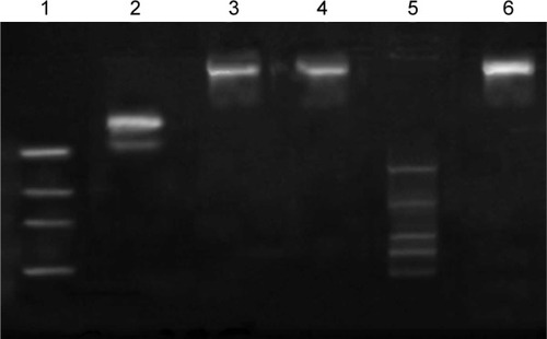 Figure 4 Agarose gel electrophoresis analysis of siRNA loading and protection by liposomal vectors: lane 1, marker (50 bp); lane 2, HIF-1α siRNA alone; lane 3, siRNA-fc-LPs; lane 4, siRNA-fc-LPs treated with sodium heparin; lane 5, HIF-1α siRNA + RNase; and lane 6, siRNA-fc-LPs + RNase.Abbreviations: siRNA, small interfering RNA; HIF-1α, hypoxia-inducible factor-1α; siRNA-fc-LPs, siRNA-loaded folate-decorated cationic liposomes; RNase, ribonuclease.