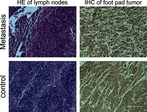 Figure 11 Results of histological examination of lymph (H&E stain, original magnification 400×) and transplanted tumors (immunohistochemical [IHC], original magnification 400×).Notes: Top row, metastasis group; bottom row, control group.