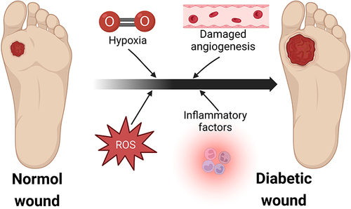 Figure 4 The formation of diabetic foot. Normal wounds in diabetic patients gradually develop into chronic hard-to-heal wounds due to hypoxia, increased ROS (reactive oxygen species) and inflammatory factors, and impaired angiogenesis. (Image created with BioRender.com).