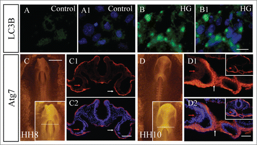 Figure 3. Exposure of high glucose promoted autophagy in gastrula chick embryos. (A and B) The LC3B fluorescence immunostaining was performed in primary cell culture from either control (A-A1) or RAPA-treated (B-B1) embryos. A1 and B1 are merged images with DAPI staining, respectively. (C and D) Atg7 fluorescence immunostaining was performed in HH8 (C) and HH10 (D) chick embryos. High-magnification images at the cranial region are on the right corner of C and D. (C1-C2) Transverse sections at the level indicated by the white dotted line in C. C1 is Atg7 fluorescence staining only, and C2 is the merger of DAPI and C1. (D1-D2) Transverse sections at the level indicated by the white dotted line in D. D1 is Atg7 fluorescence staining only, and D2 is the merger of DAPI and D1. Abbreviations: HG, high glucose. Scale bars = 10 μm in A-B1; 500 μm in C and D; 100 μm in C1-C2; 50 μm in D1-D2.