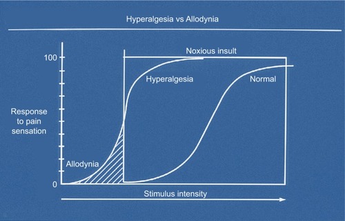 Figure 1 Hyperalgesia and allodynia.