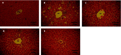 Figure 3. Histopathological changes in the liver tissue of normal and CCl4-treated rats. (A) Group I: normal control rats; centrally located and round nuclei and homogeneous cytoplasm (arrows). (B) Group II: CCl4-treated rats, cell necrosis (arrows). (C) Group III: rats treated with silymarin plus CCl4. (D) Group IV: rats treated with dual-coated probiotics plus CCl4. (E) Group V: rats treated with uncoated probiotics plus CCl4. Note: H&E staining; magnification ×400; bar = 200 μm.