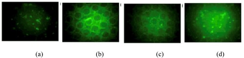 Figure 6. E Coli adhesion on patterned silicone surfaces with cones of diameters (a) 20 μm (b) 25 μm (c) 30 μm and (d) 40 μm, after a 5-hour contact period. Image adapted from [Citation20].
