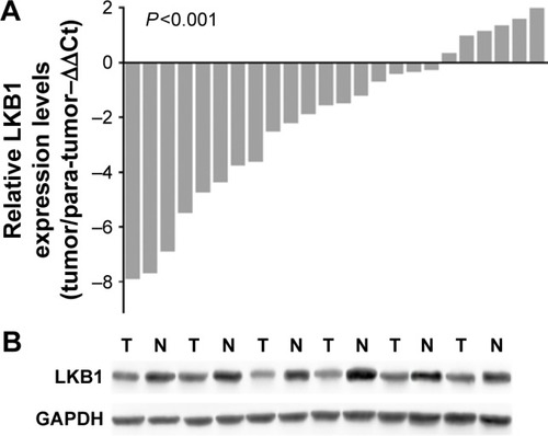 Figure 1 LKB1 mRNA and protein levels in pNET tissues and paired normal tissues.