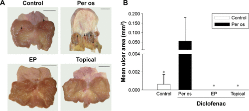 Figure S1 Gastric adverse effects of diclofenac intake.Notes: The effects of diclofenac treatment on the gastric mucosa. (A) Diclofenac treatment-induced gastric adverse effects. Scale bars represent 10 mm. Black arrows show edema, irritation, and petechia formation. (B) Mean area of gastric lesions. The white column represents the control group (per os saline-treated), and the black column represents the per os diclofenac-treated group. The pale and dark columns (not visible, as values are 0.000) represent the topical and EP-combined topical diclofenac-treated groups, respectively. Data are presented as means ± SD. *p<0.05 vs per os diclofenac-treated group (Kruskal–Wallis one-way analysis and Dunnet test).Abbreviations: EP, electroporation; SD, standard deviation of the mean.